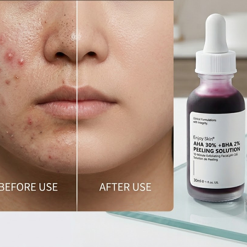 Shopoletcosh Radiance Reveal: Advanced Exfoliating Concentrate - Instant Glow, Pore Minimizer & Skin Brightening Treatment