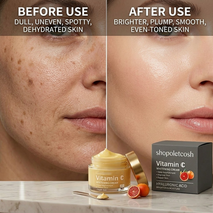 Shopoletcosh Vitamin C Glass Skin Cream: Intense Brightening Complex with Vitamin E - For a Clear, Dewy & Healthy Complexion